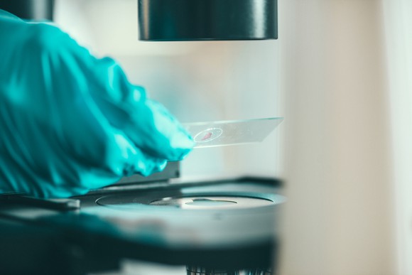 Placing sample under microscope.