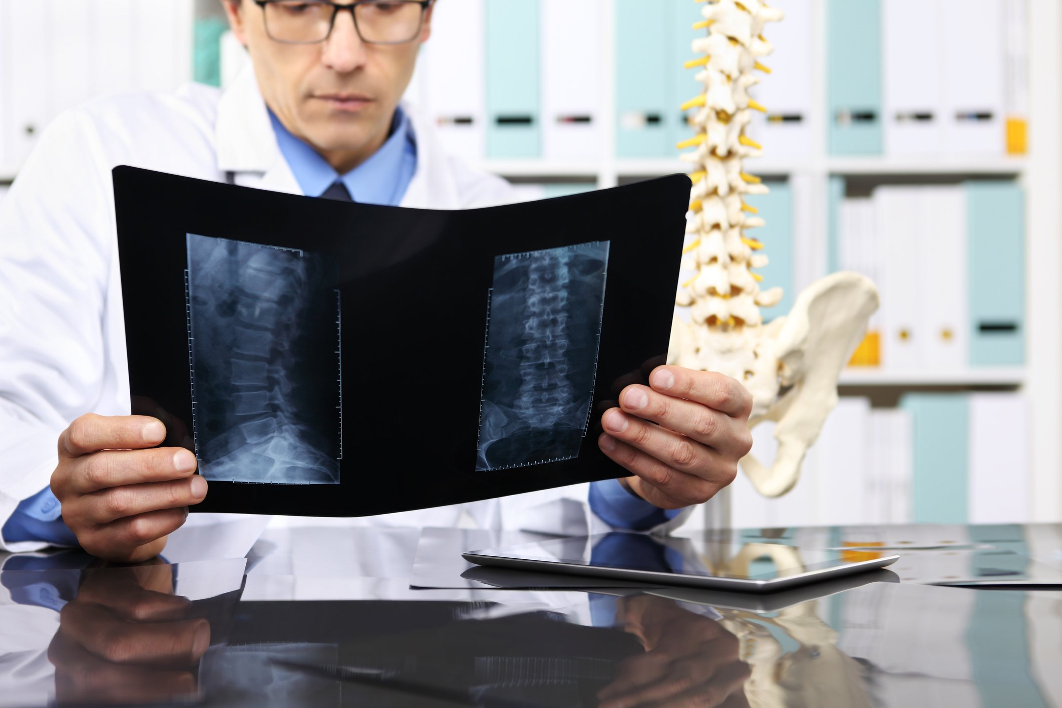 Doctor looking at an X-ray of a spine with a model of a spine in the background