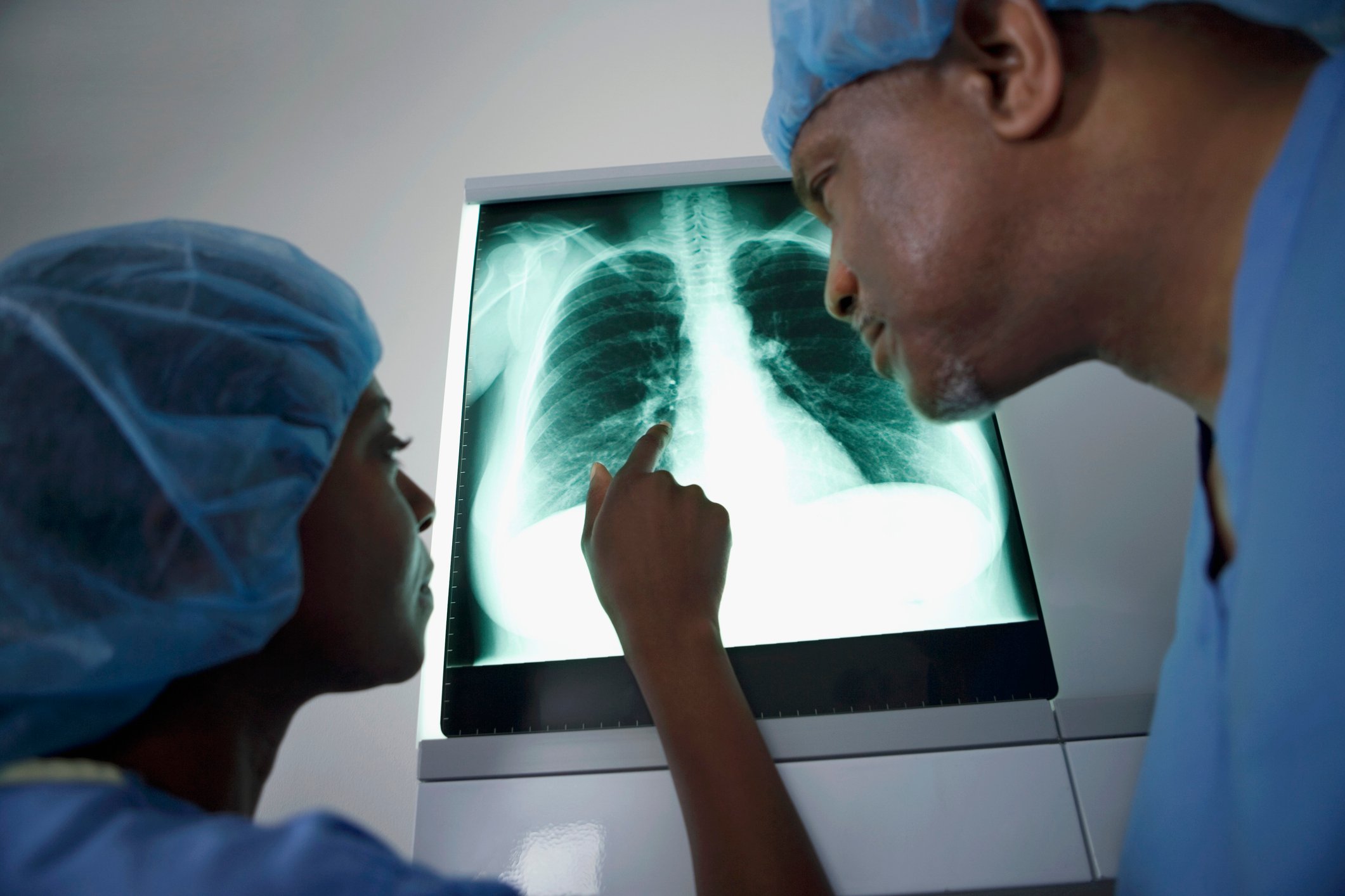 Surgeons looking at a lung x-ray.