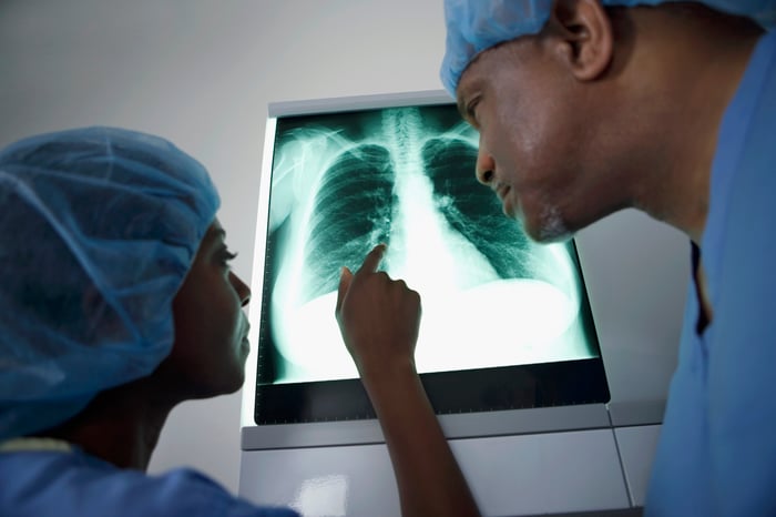Surgeons looking at a lung x-ray.