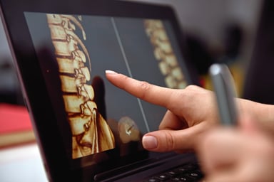 Spine image on monitor
