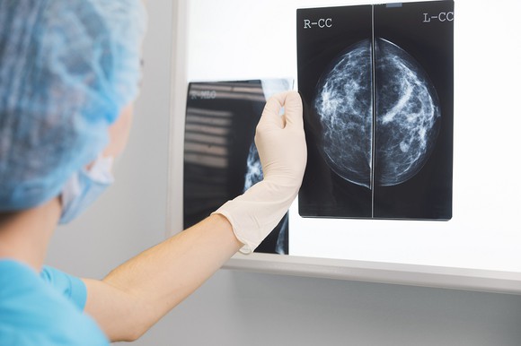 Medical professional examining mammogram.