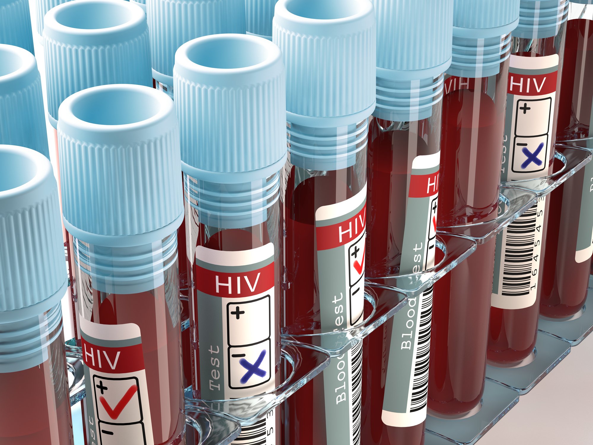 Blood vials being tested for HIV
