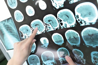 Neuro