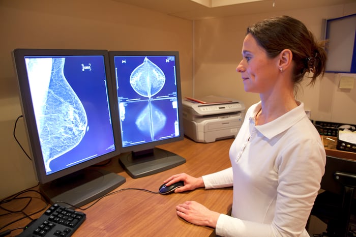 Technician looks at mammogram results on a computer