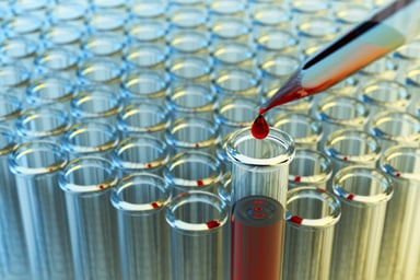 GettyImages-539842896