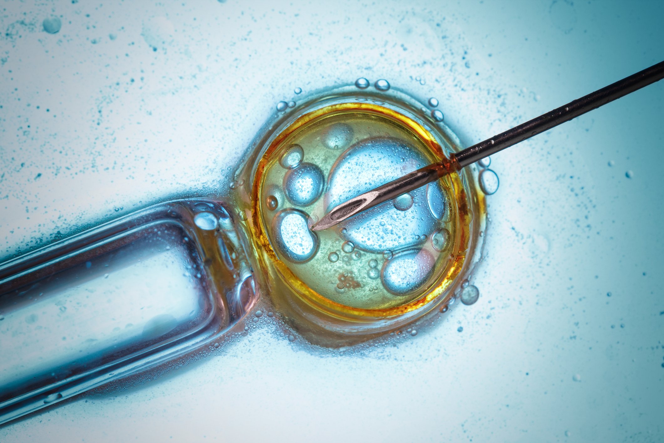 Microscope image of needle poking into cell.