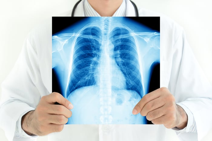 Doctor holding up a chest X-ray in front of him.