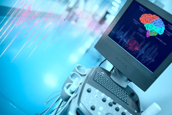 Brain examination using a modern machine.