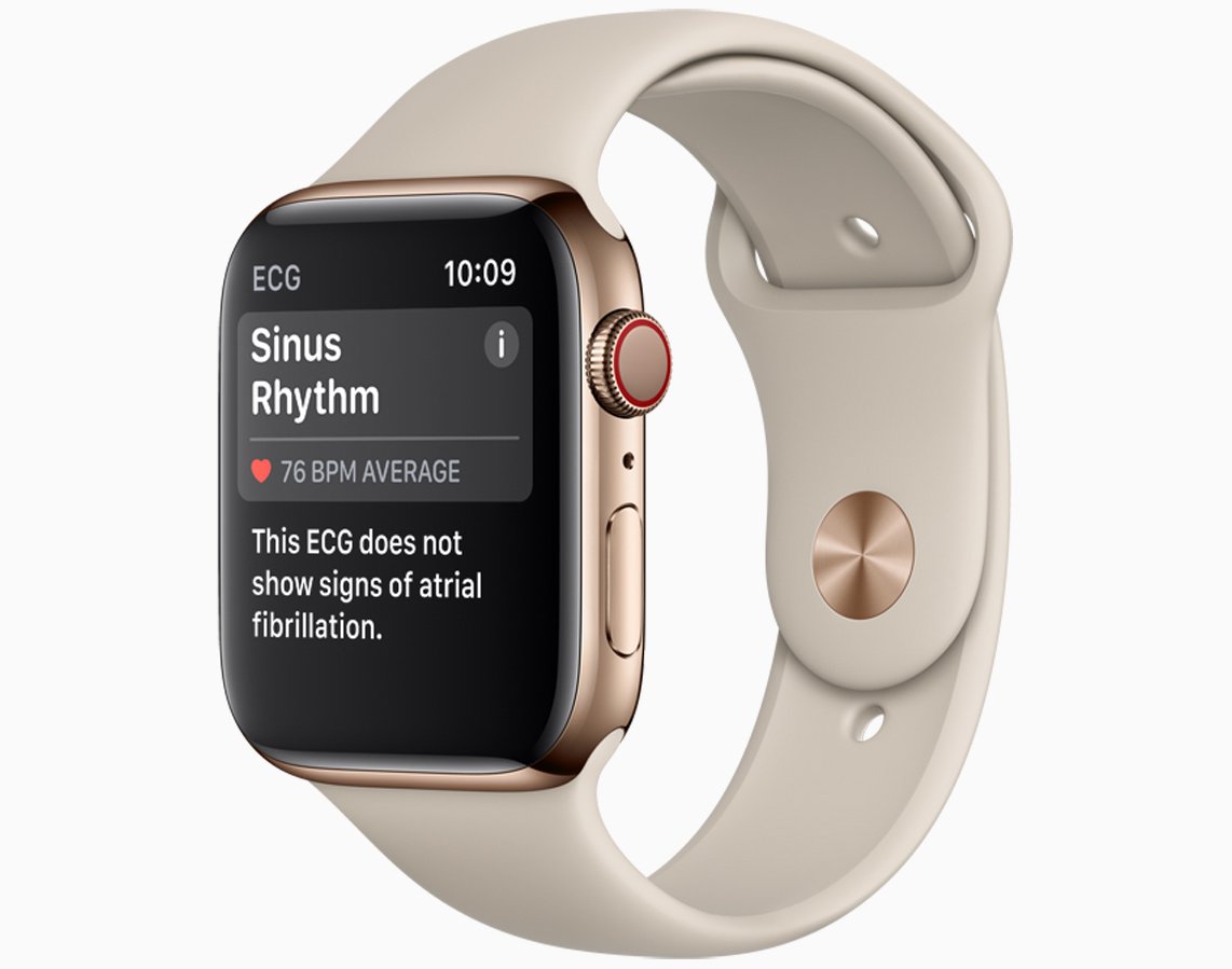 Image of the Apple Watch. 