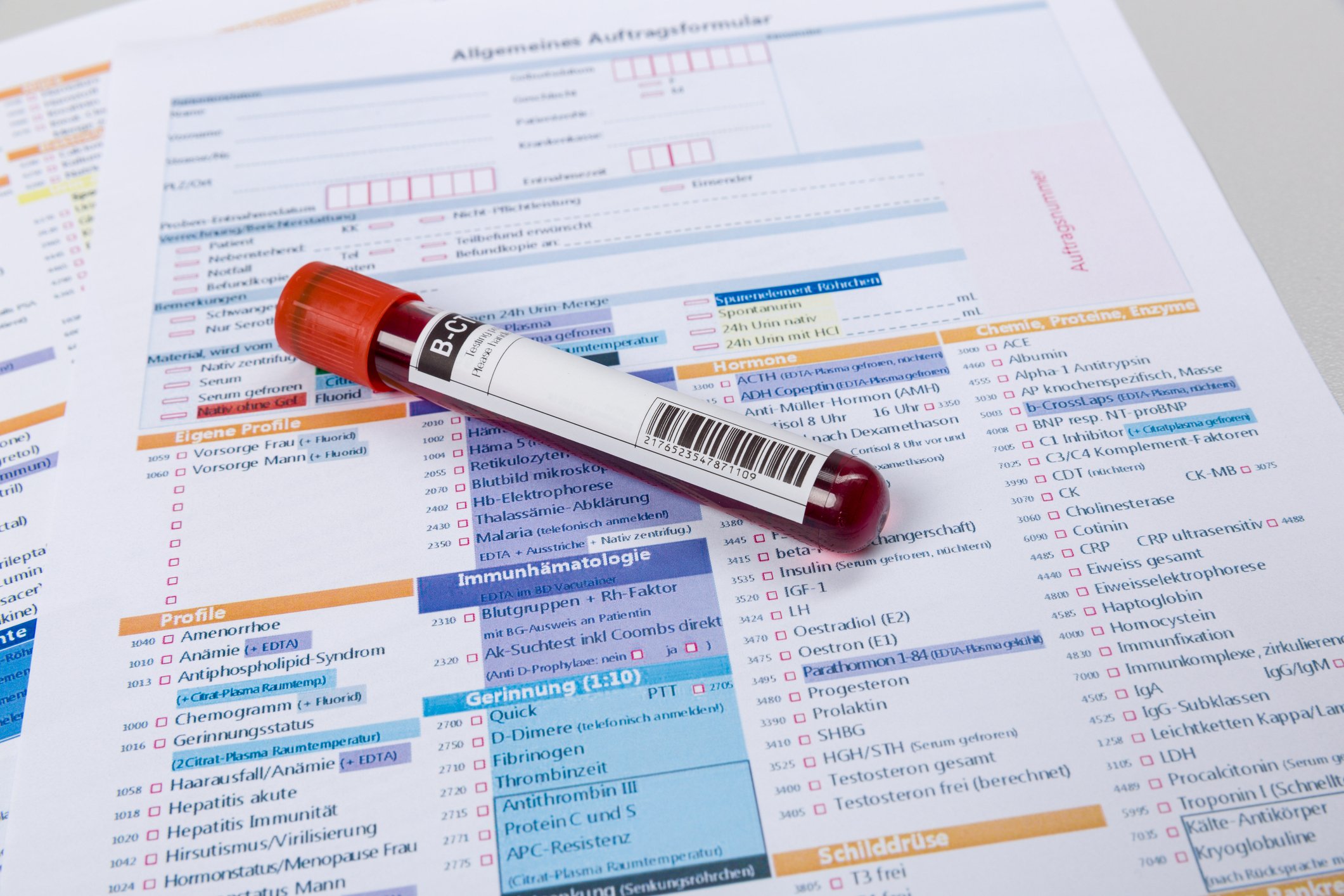 Blood sample on top of lab test paperwork