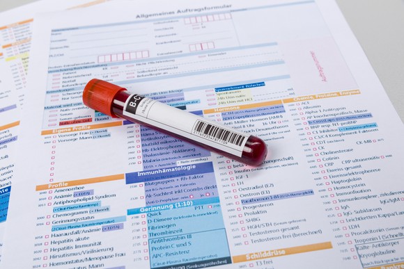 Blood sample on top of lab test paperwork
