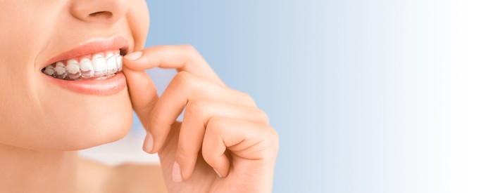 Close-up of a woman either inserting, taking out, or adjusting her clear dental retainer.