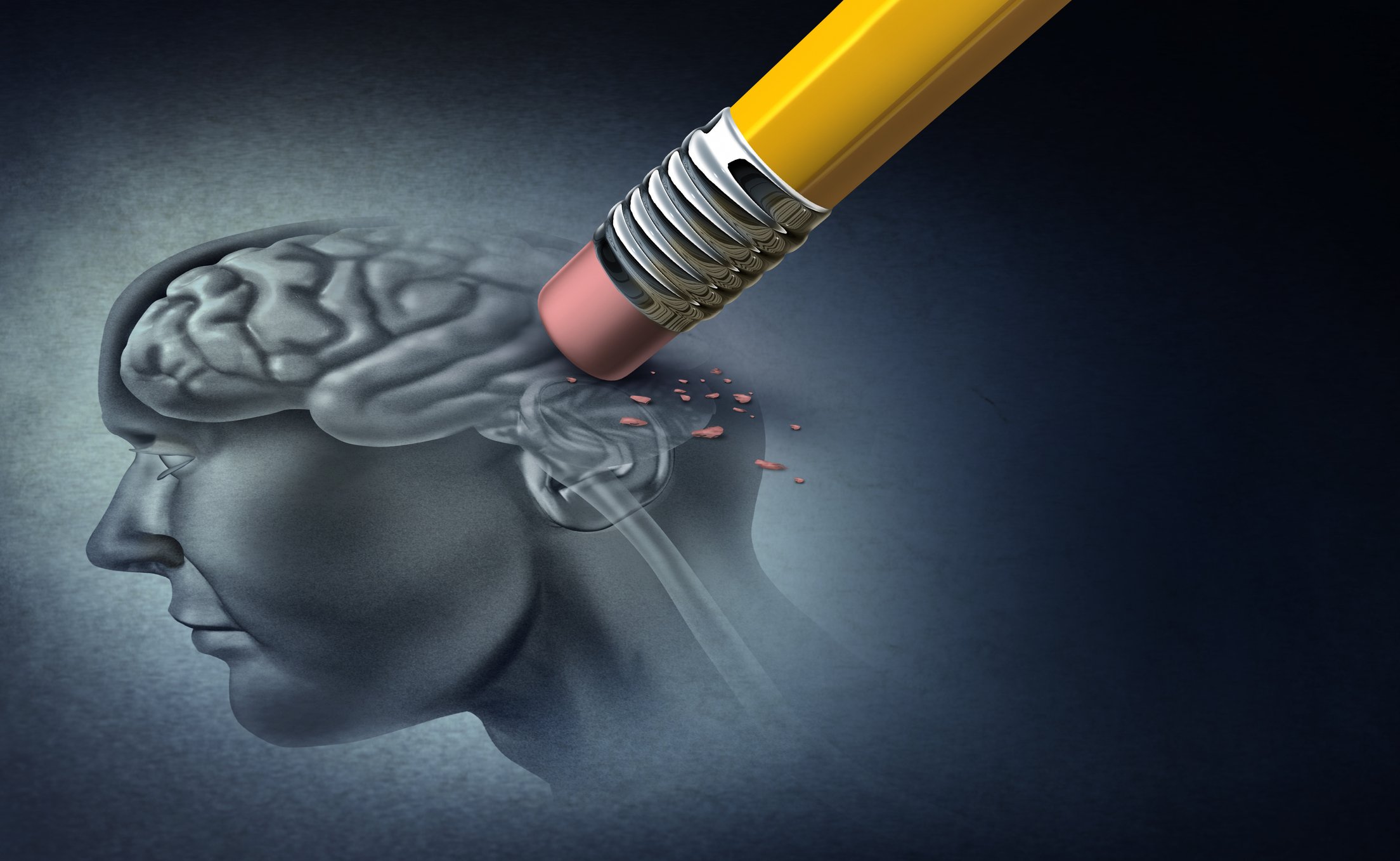 Cartoon of a pencil erasing a portion of a person's brain.