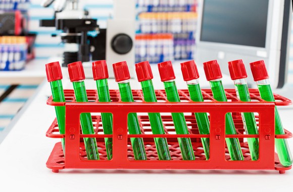 A rack of glass vials filled with a green liquid.