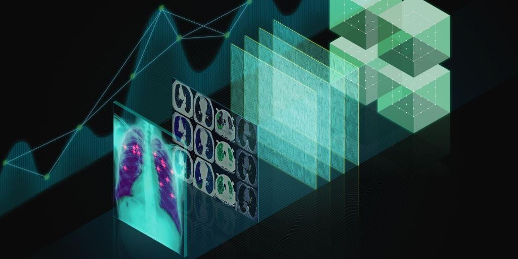 An x-ray image of lungs and digital data, illustrating NVIDIA's GPU use for healthcare imaging.