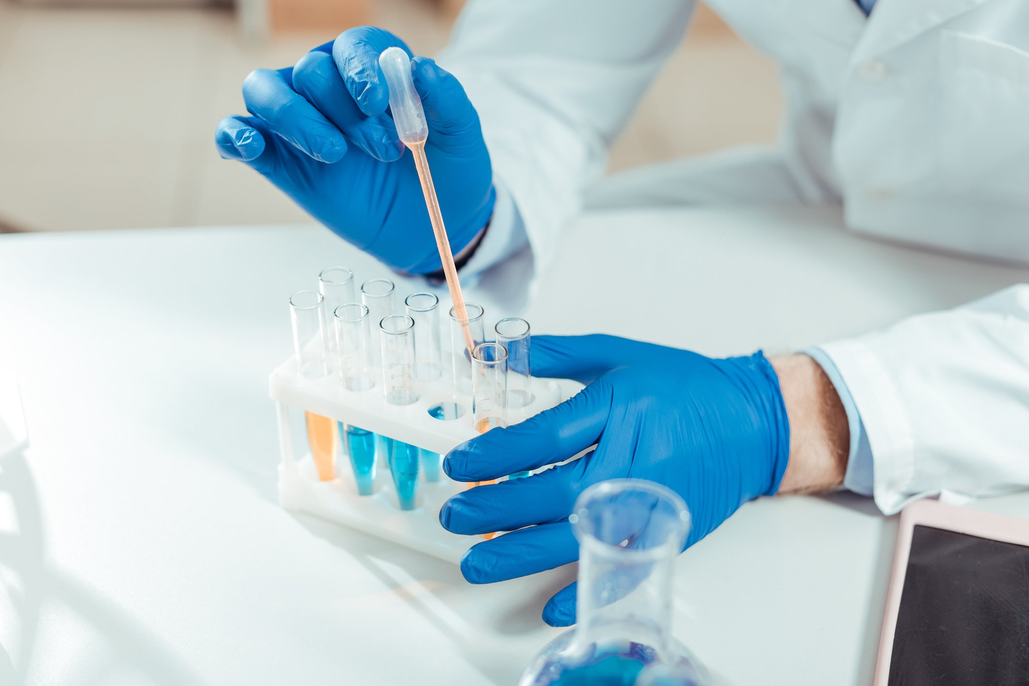 Lab technician holding an eyedropper collecting samples from test tubes.