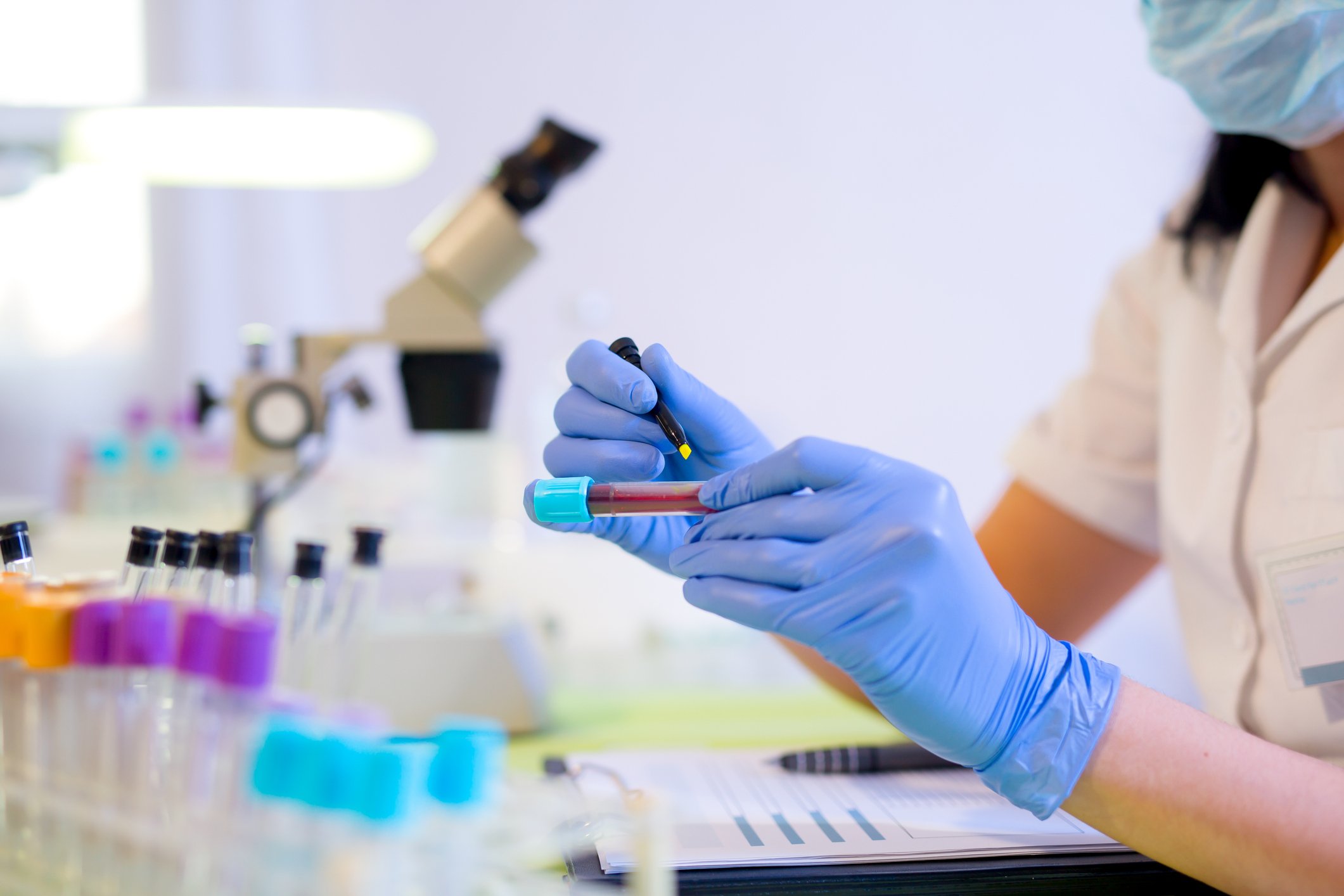 Person in a lab holding vial with blood sample 