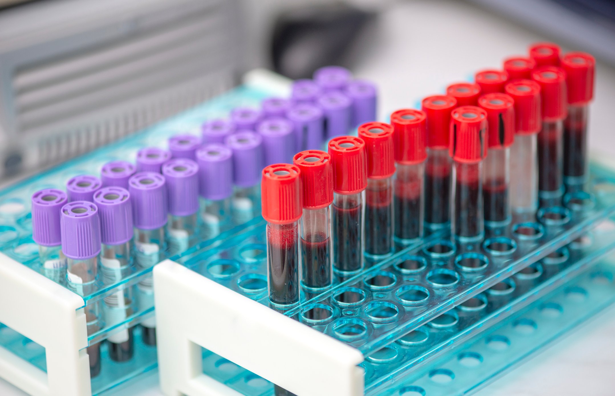 Tubes of Blood for Sampling