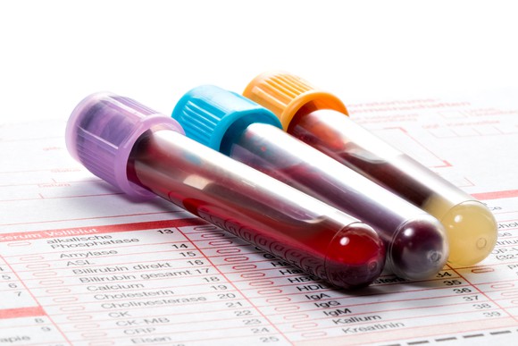 Three blood vials on a diagnostic test order form.