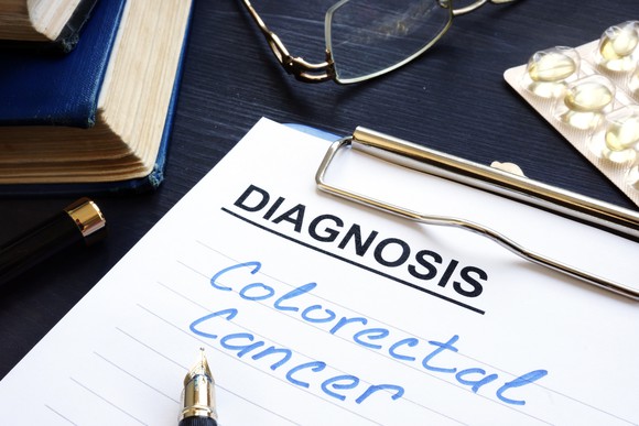 Diagnosis notepad with Colorectal Cancer in blue ink