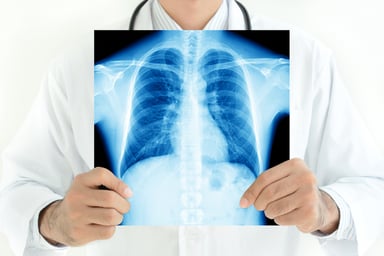 doctor-with-chest-lung-x-ray