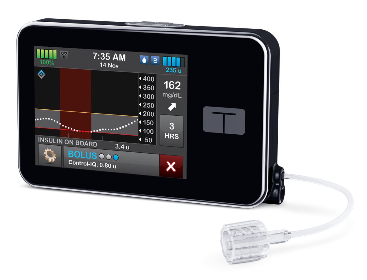 Tandem Diabetes Launches A New Version Of Its Insulin Pump The Motley Fool