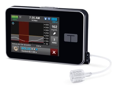 tslim_X2_Insulin_Pump_Right_View_Control-IQ_RGB