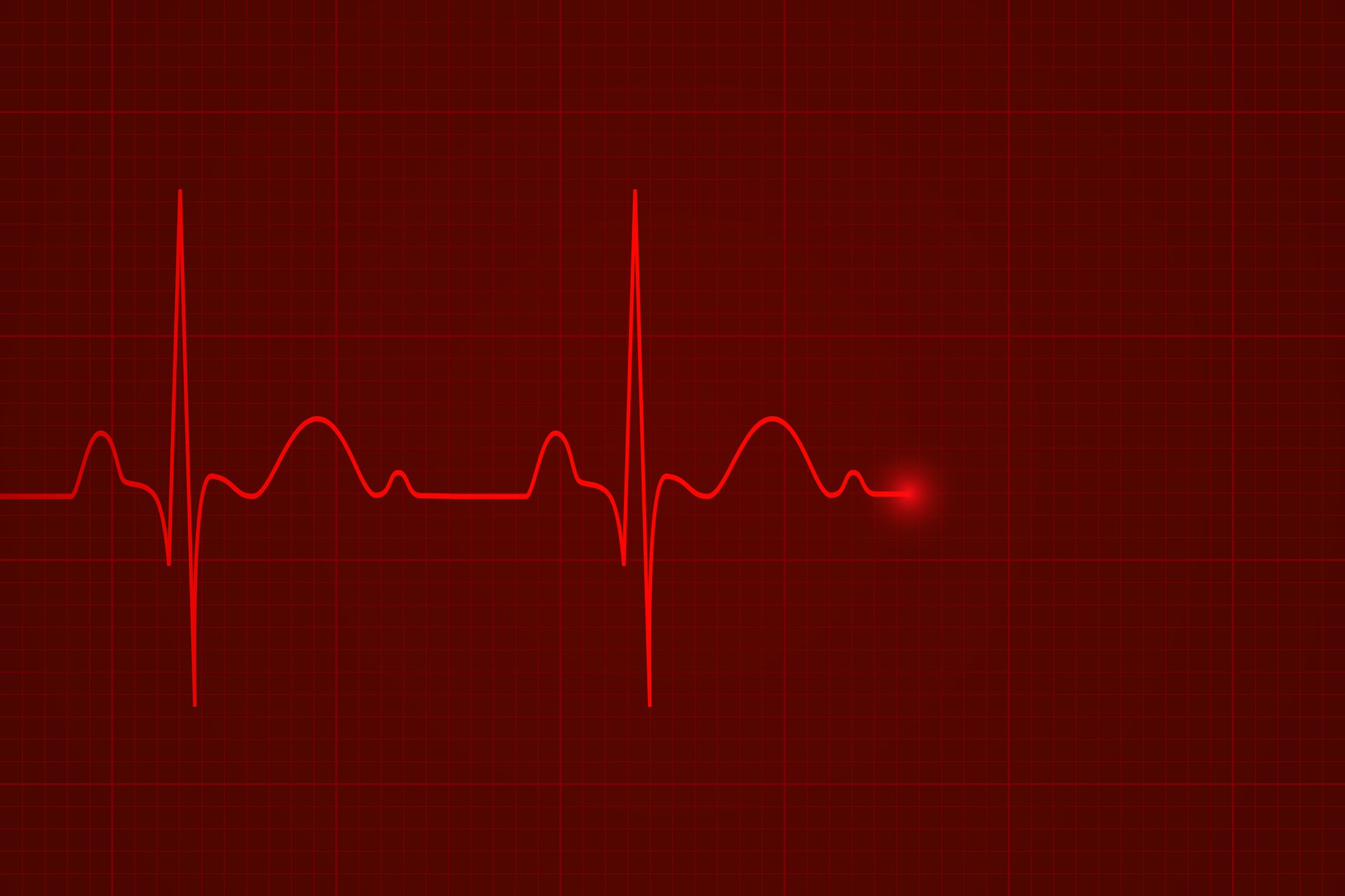 Glowing red heartbeat monitor graph flatlines