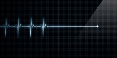 EKG-dead
