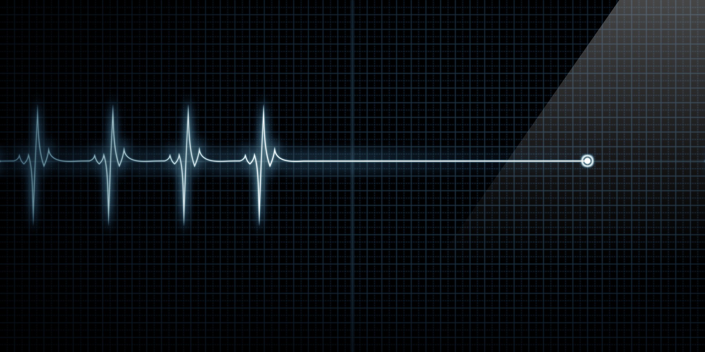 EKG image, indicating the end of heart beats.