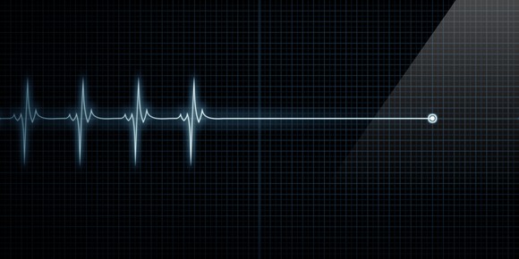 EKG image, indicating the end of heart beats.