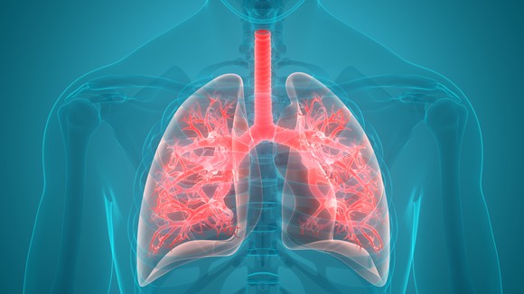 A close-up of a persons lungs and the airway tracts that encompass it.