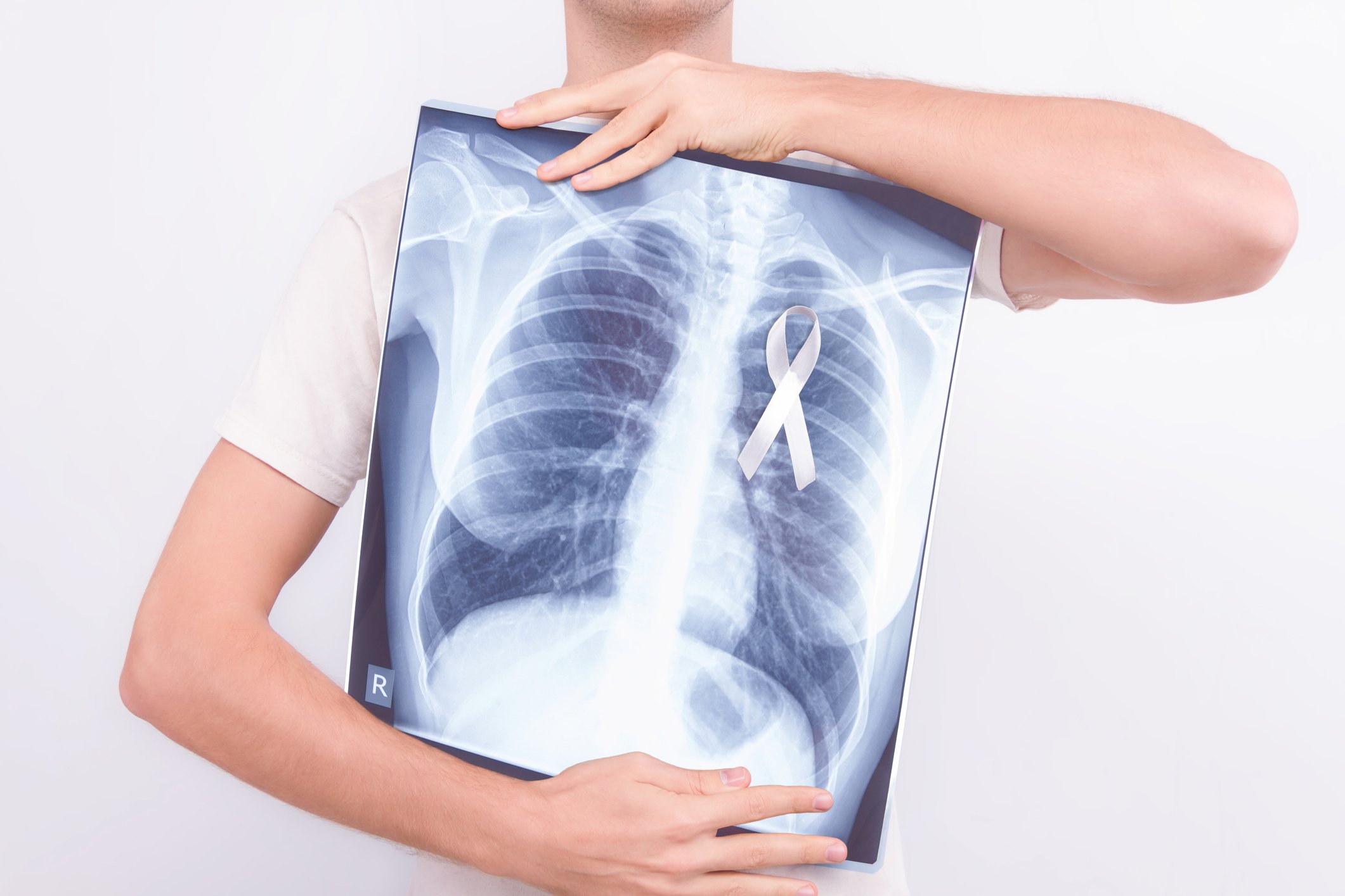 A person holding an x-ray of their lungs with a cancer ribbon on it.