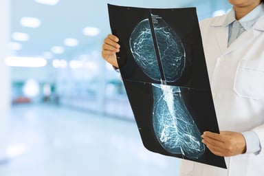 breast cancer xray