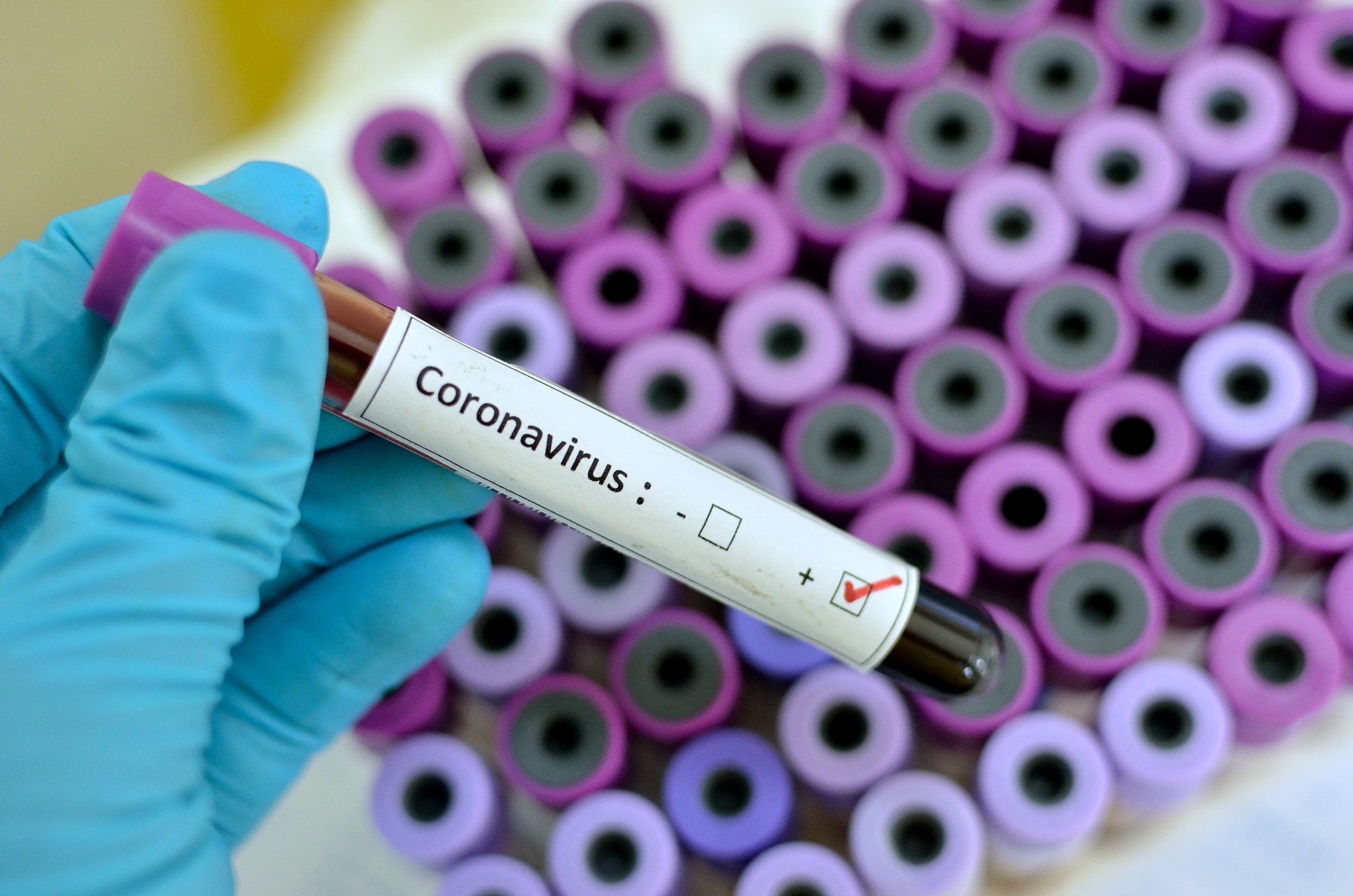 Gloved hand holding a vial with a label showing "Coronavirus" with a check in a box next to a plus sign