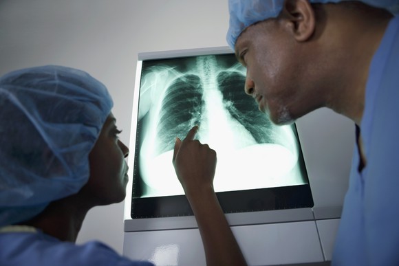 Two surgeons examining a patient's chest X-ray.