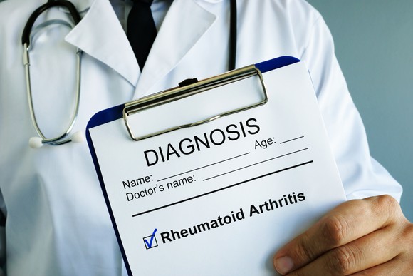 A doctor holds a chart that says: "Diagnosis: rheumatoid arthritis"