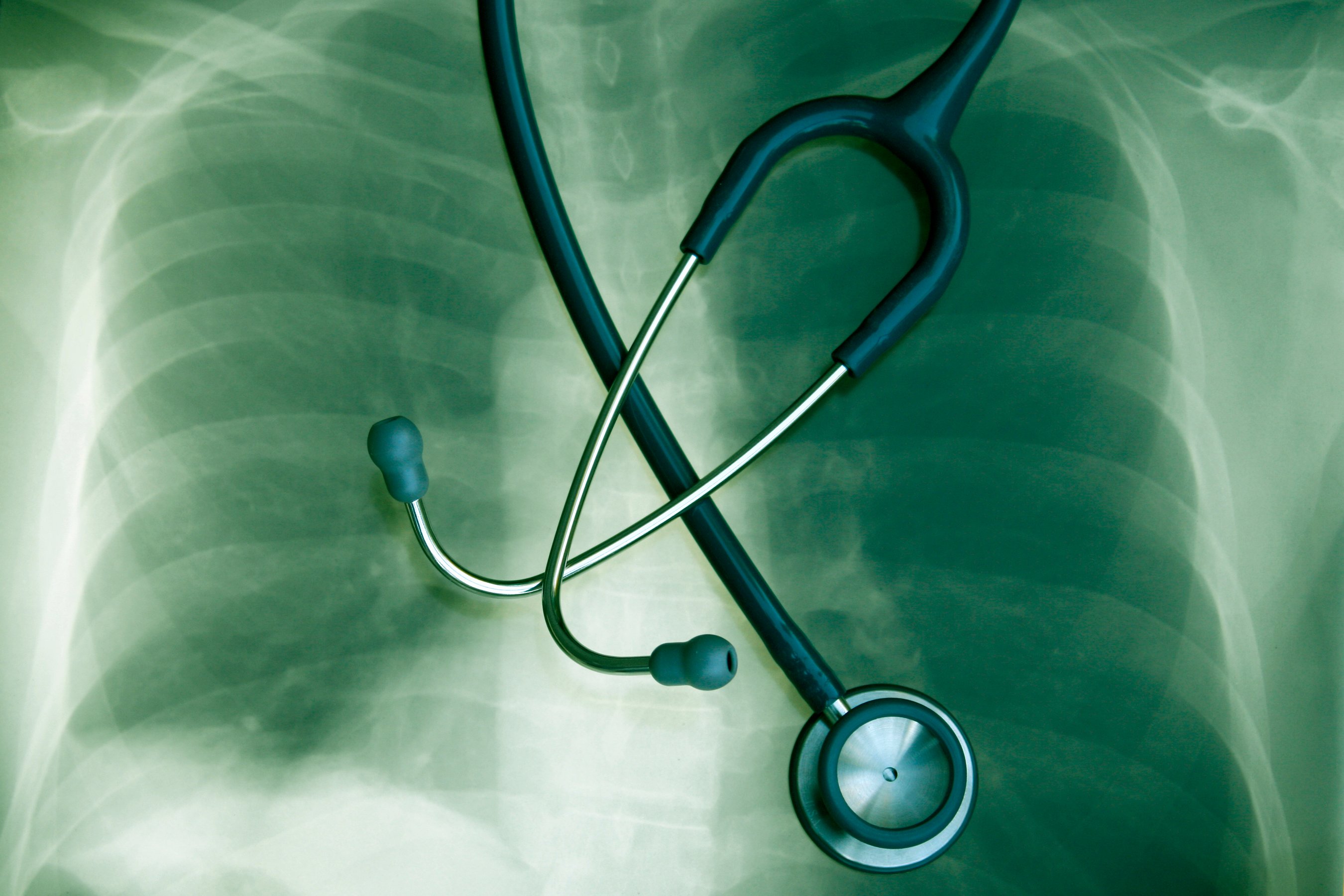 An X-ray of a person's lungs with a stethoscope placed on top. 