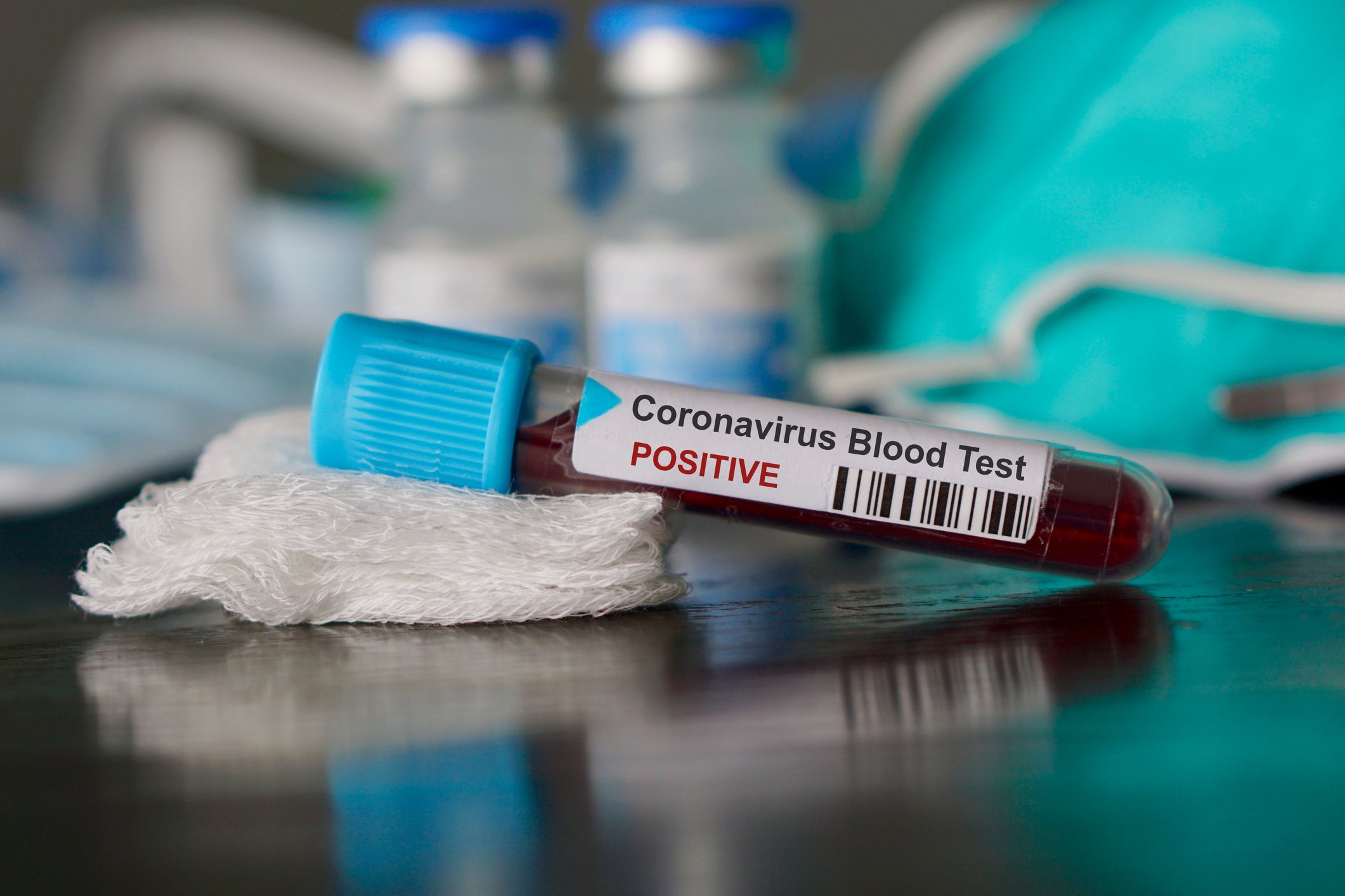 A vial of blood labeled positive for coronavirus.