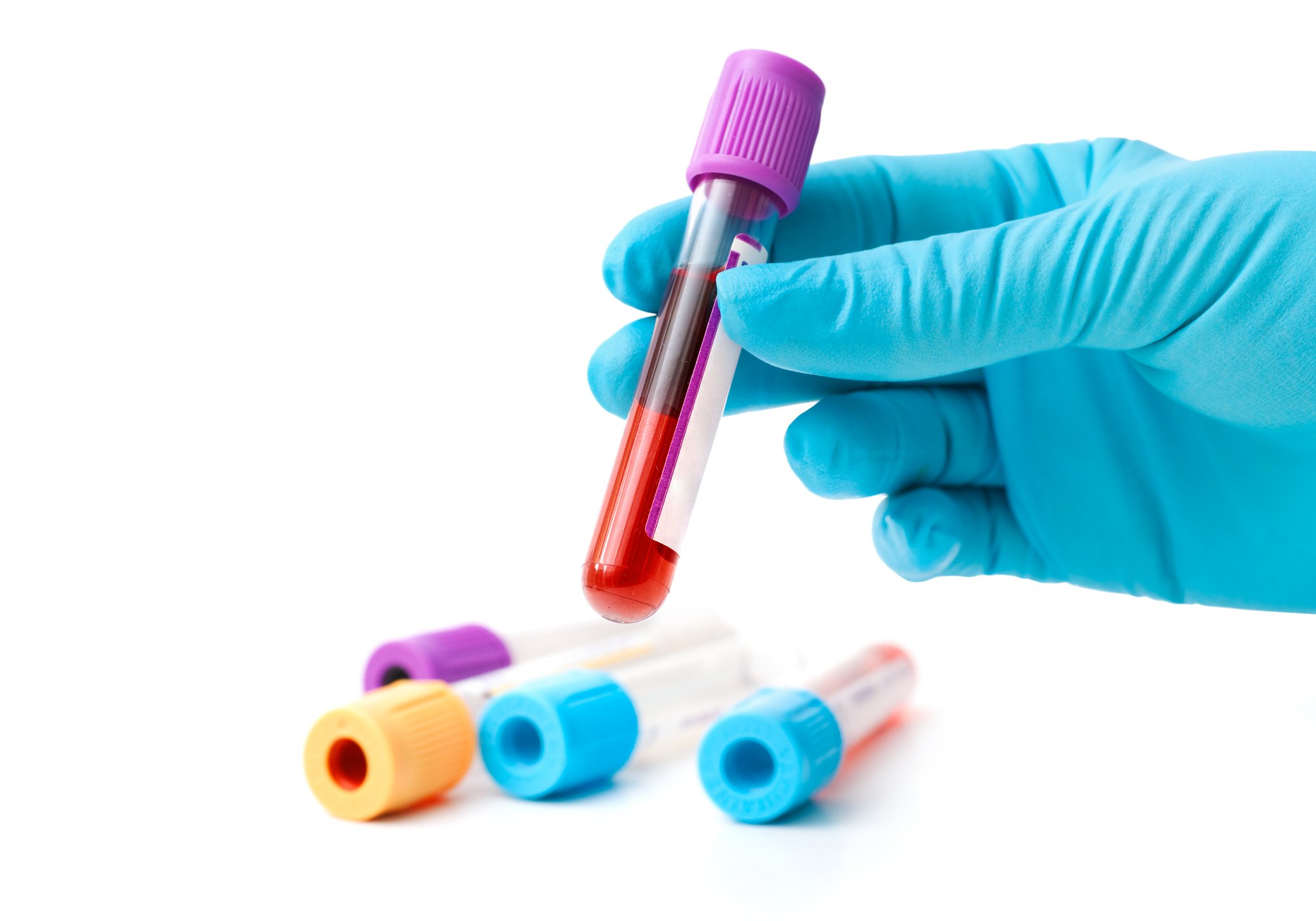 Hand with blue latex glove holding test tube of blood