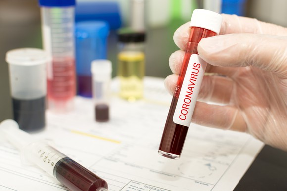 Hand holding test tube of blood labeled Coronavirus testing