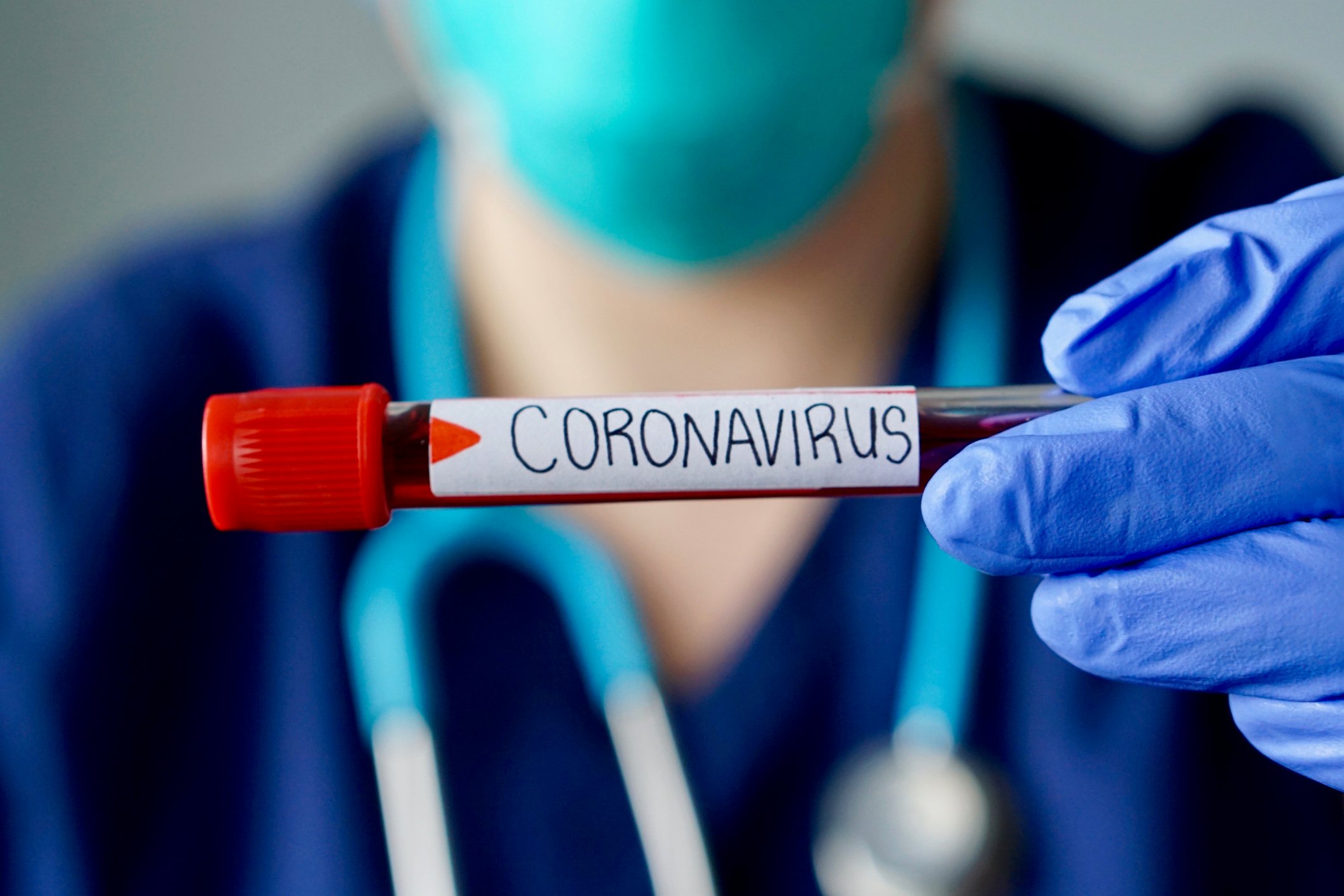 Coronavirus blood vial