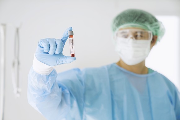Scientist wearing a mask and safety glasses holding a vial of blood with a label printed on the vial stating coronavirus
