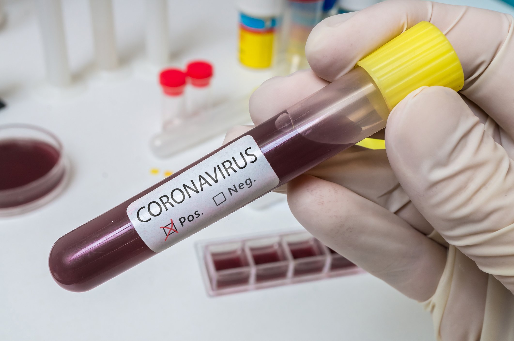 Gloved hand holding vial of blood with a label stating coronavirus positive.
