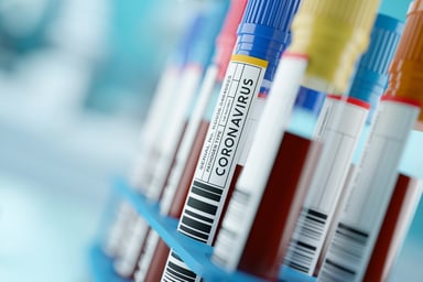 Coronavirus vials
