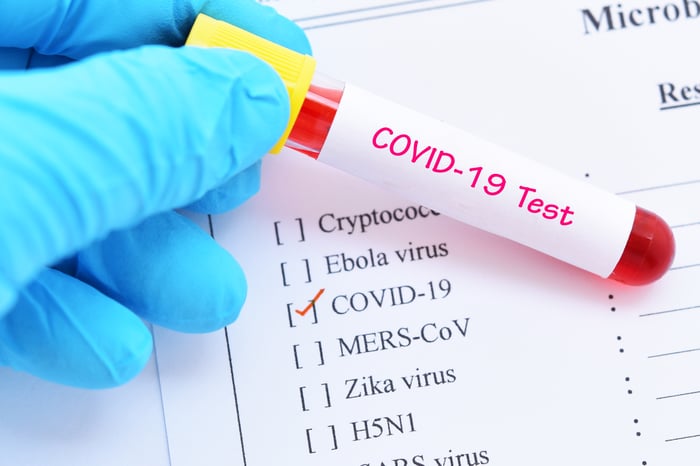 A COVID-19 blood sample