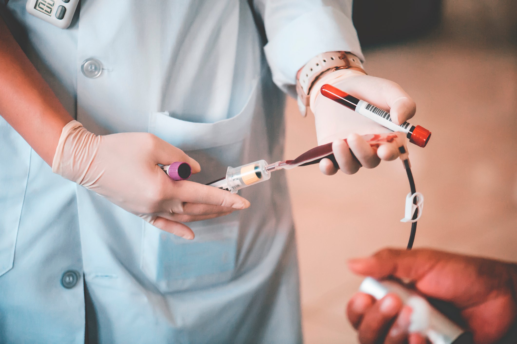 A nurse taking a blood donation from a donor.