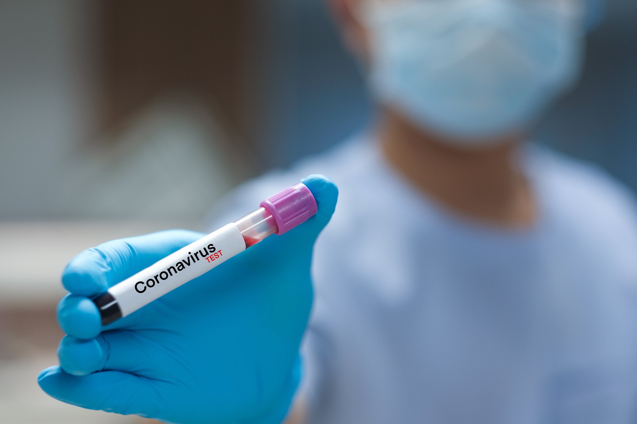 A COVID-19 test sample.