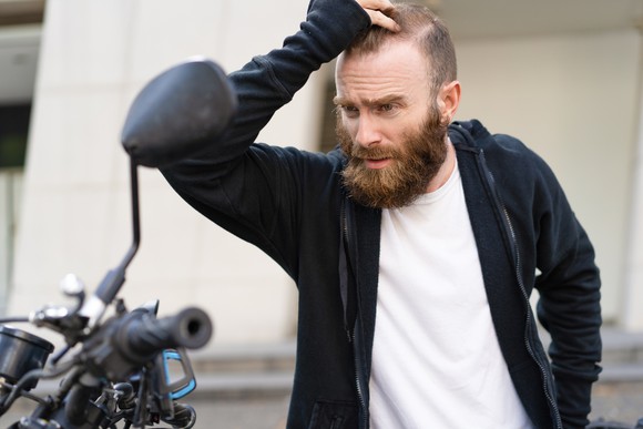 Motorcyclist looking upset over his damaged motorcycle.